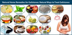 Natural home remedies for gallstones: Natural Ways to Treat Gallstones